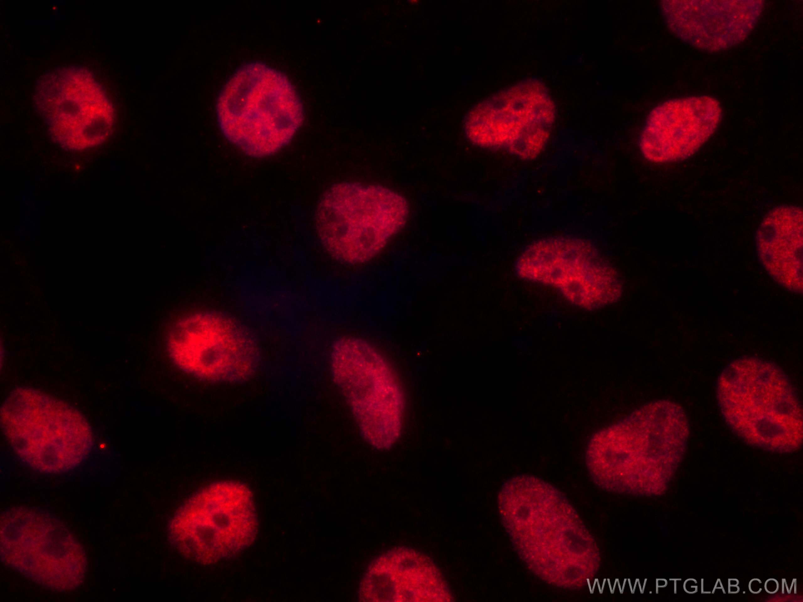 Immunofluorescence (IF) / fluorescent staining of A431 cells using CoraLite®594-conjugated RPA2 Monoclonal antibody (CL594-67999)