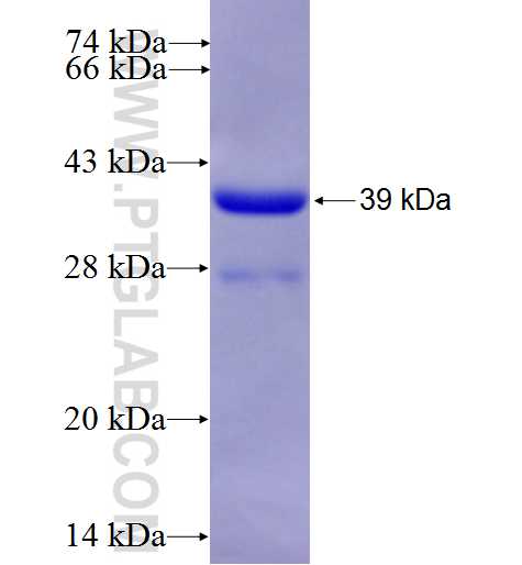 RPA3 fusion protein Ag1065 SDS-PAGE