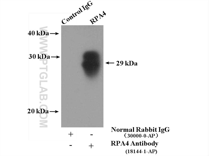 Immunoprecipitation (IP) experiment of HeLa cells using RPA4 Polyclonal antibody (18144-1-AP)