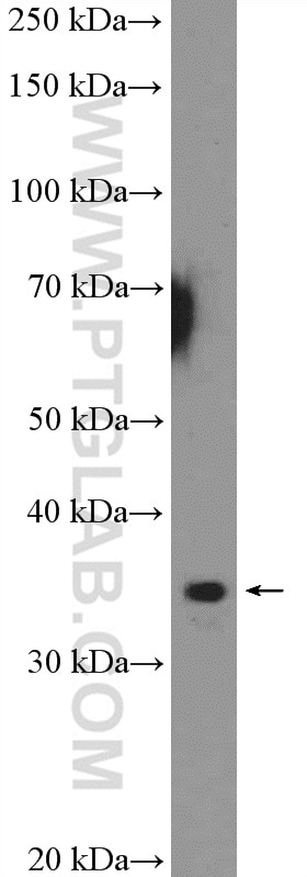 Western Blot (WB) analysis of mouse spleen tissue using RPA4 Polyclonal antibody (18144-1-AP)