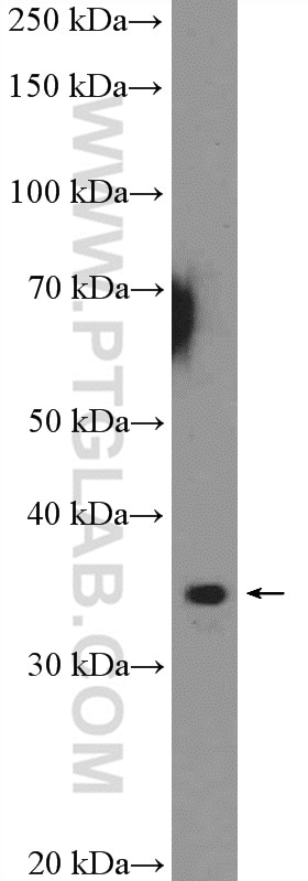 WB analysis of mouse spleen using 18144-1-AP