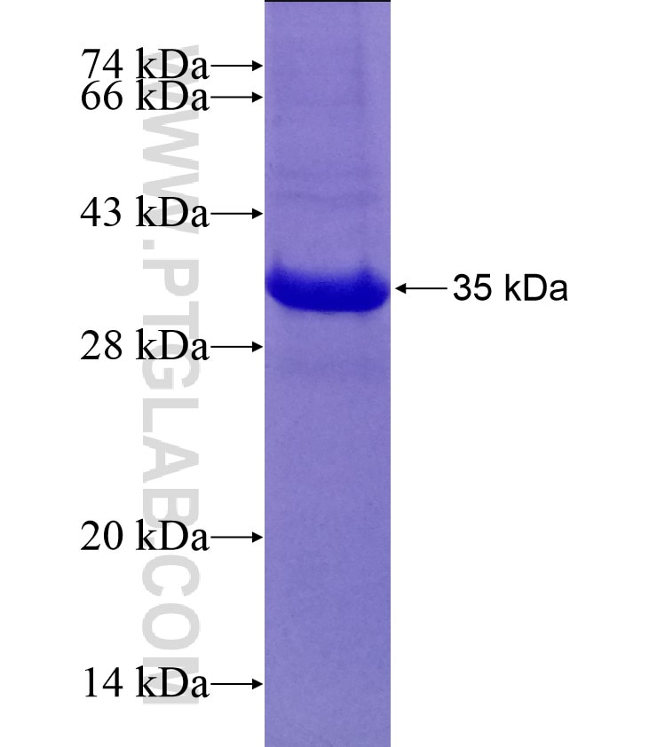 RPA4 fusion protein Ag12791 SDS-PAGE