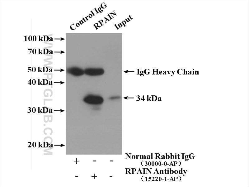 Immunoprecipitation (IP) experiment of A375 cells using RPAIN Polyclonal antibody (15220-1-AP)