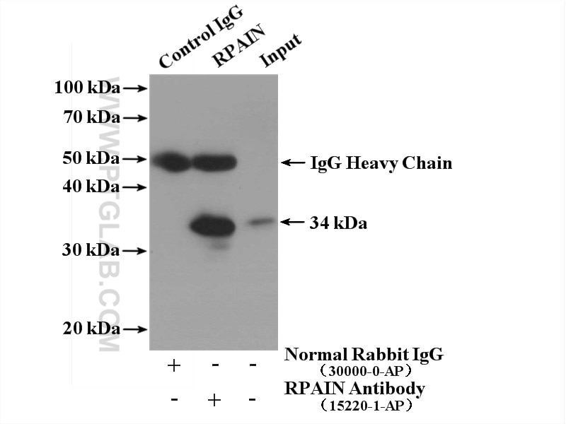 IP experiment of A375 using 15220-1-AP