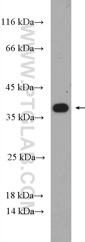 Western Blot (WB) analysis of A375 cells using RPAIN Polyclonal antibody (15220-1-AP)