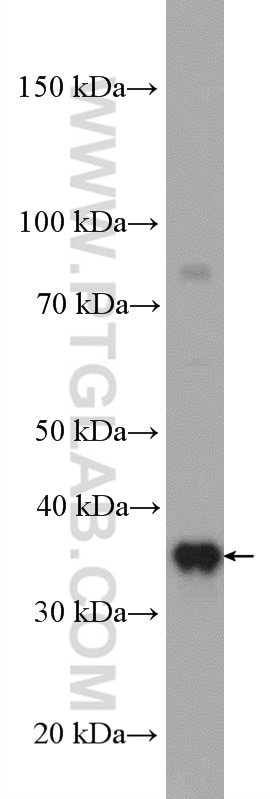 Western Blot (WB) analysis of A2780 cells using RPAIN Polyclonal antibody (15220-1-AP)