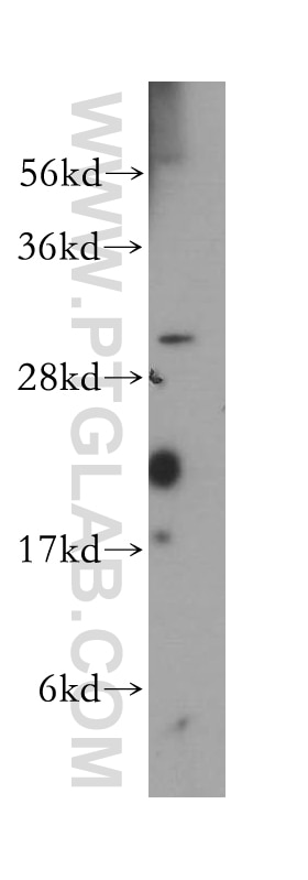Western Blot (WB) analysis of mouse ovary tissue using RPAIN Polyclonal antibody (15220-1-AP)