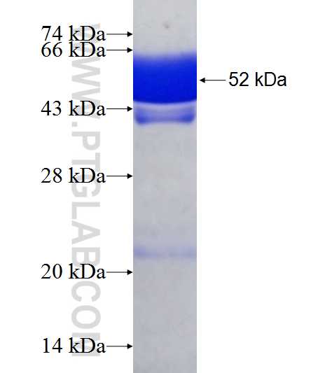 RPAIN fusion protein Ag7392 SDS-PAGE