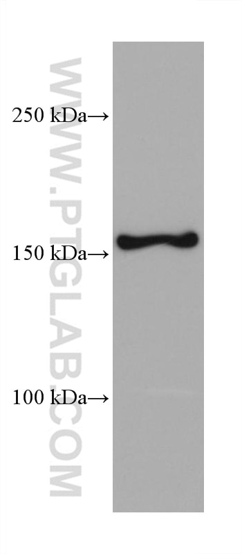 Western Blot (WB) analysis of mouse brain tissue using RPAP1 Monoclonal antibody (68193-1-Ig)