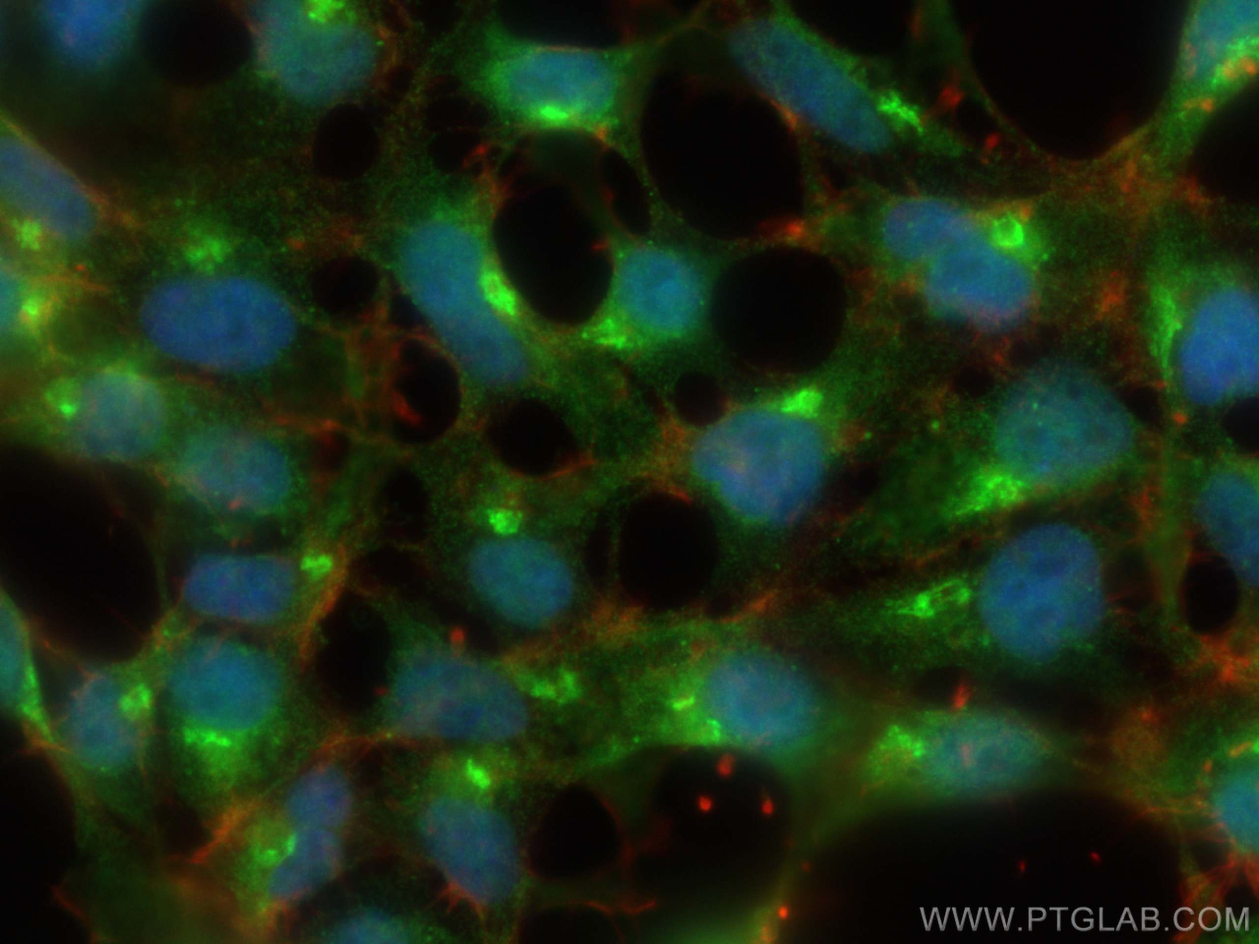Immunofluorescence (IF) / fluorescent staining of HEK-293 cells using RPAP2 Polyclonal antibody (17401-1-AP)