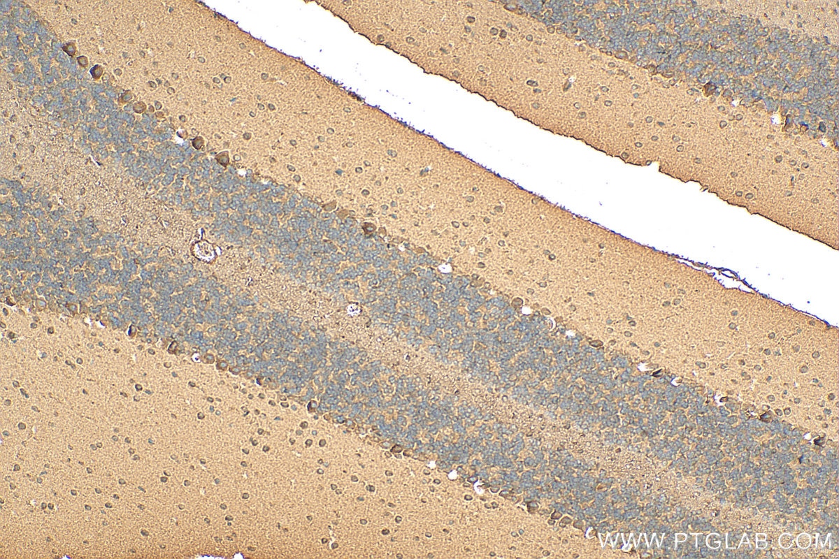 Immunohistochemistry (IHC) staining of mouse cerebellum tissue using RPAP2 Polyclonal antibody (17401-1-AP)