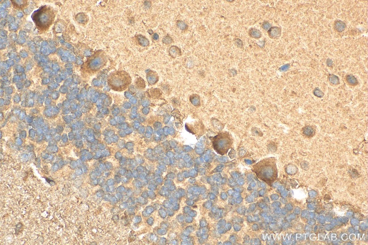 Immunohistochemistry (IHC) staining of mouse cerebellum tissue using RPAP2 Polyclonal antibody (17401-1-AP)