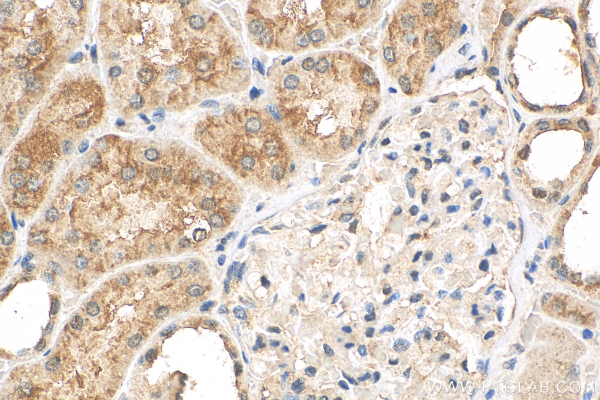 Immunohistochemistry (IHC) staining of human kidney tissue using RPAP2 Polyclonal antibody (17401-1-AP)