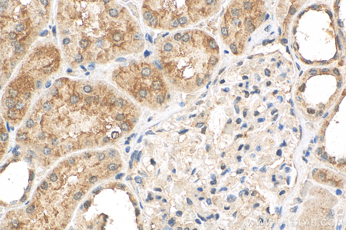 Immunohistochemistry (IHC) staining of human kidney tissue using RPAP2 Polyclonal antibody (17401-1-AP)