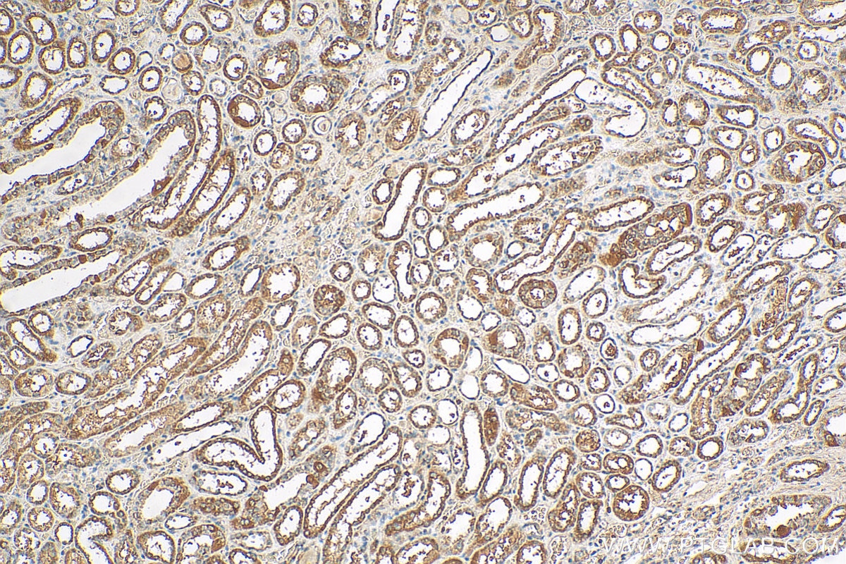 Immunohistochemistry (IHC) staining of human kidney tissue using RPAP2 Polyclonal antibody (17401-1-AP)