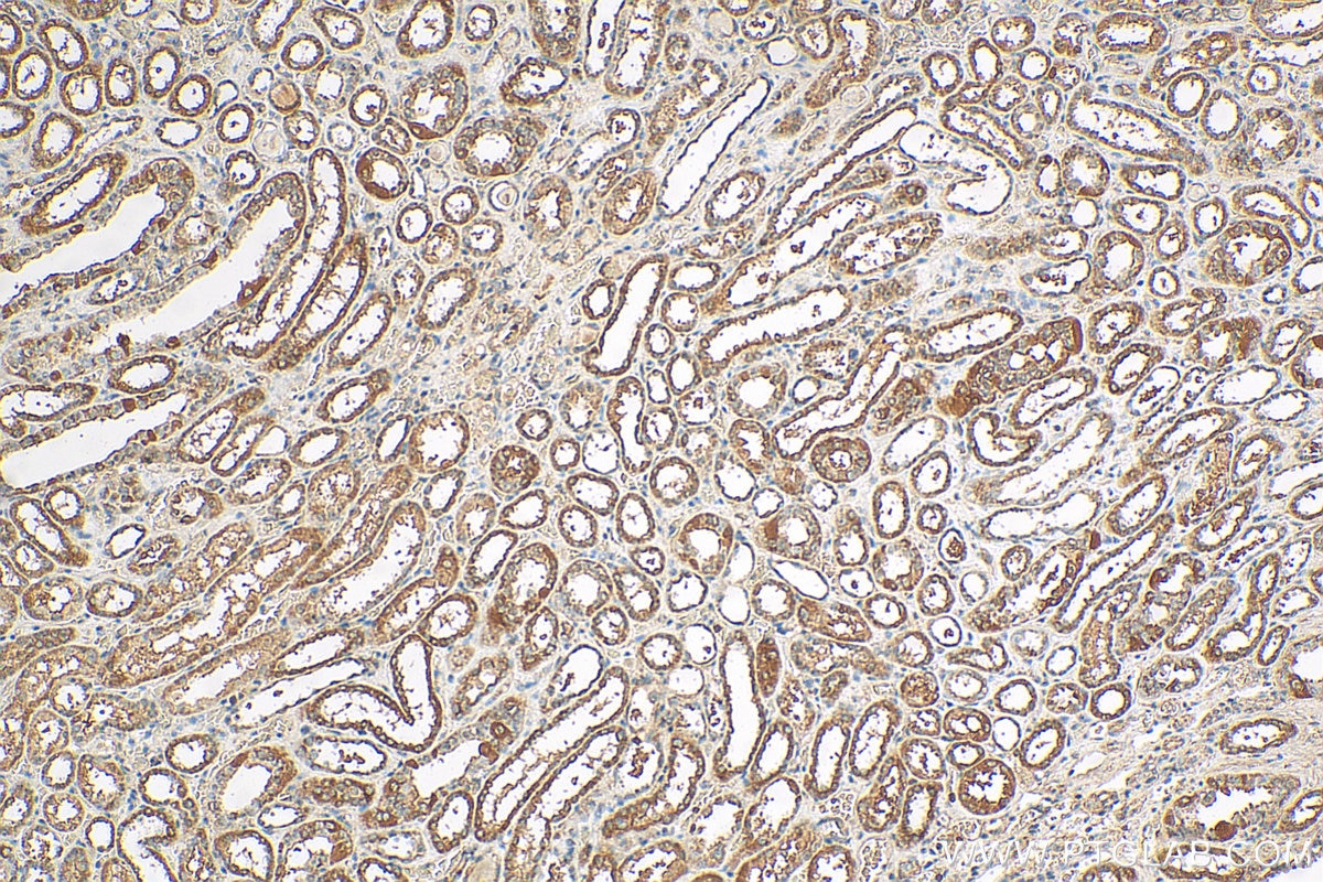 Immunohistochemistry (IHC) staining of human kidney tissue using RPAP2 Polyclonal antibody (17401-1-AP)