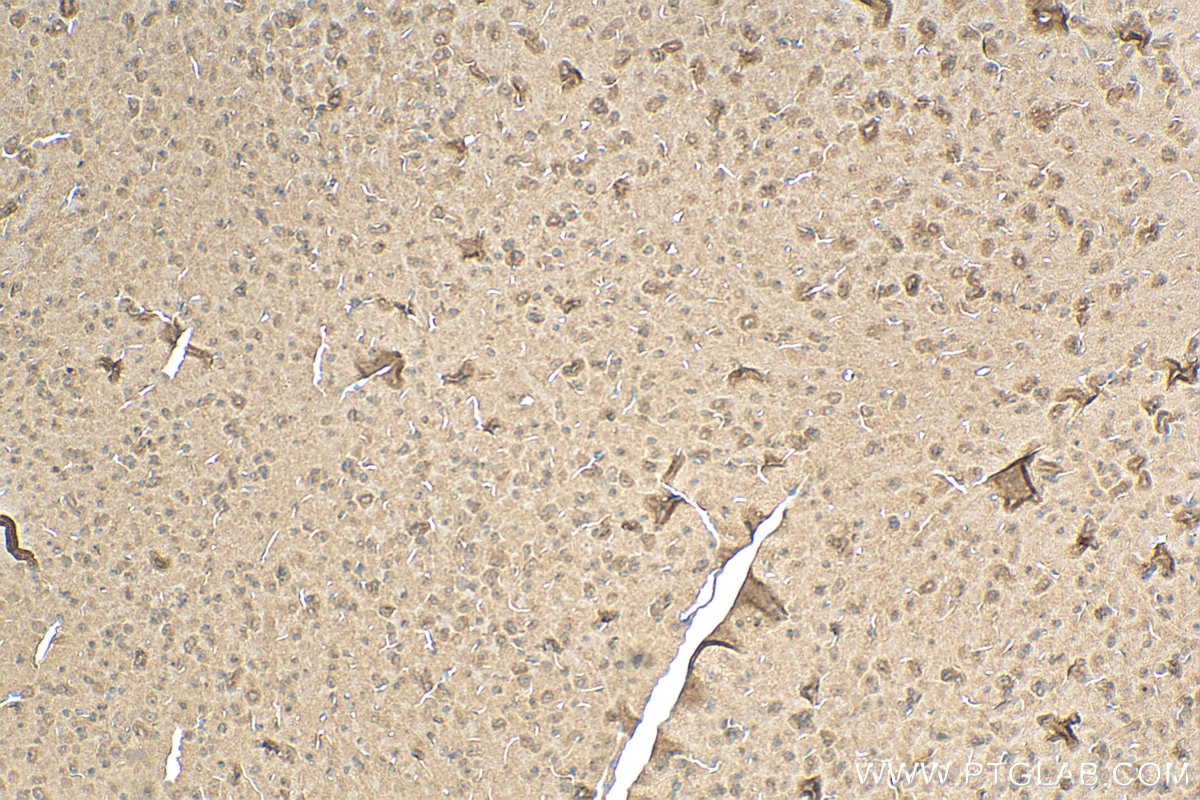 Immunohistochemistry (IHC) staining of mouse brain tissue using RPAP2 Polyclonal antibody (17401-1-AP)