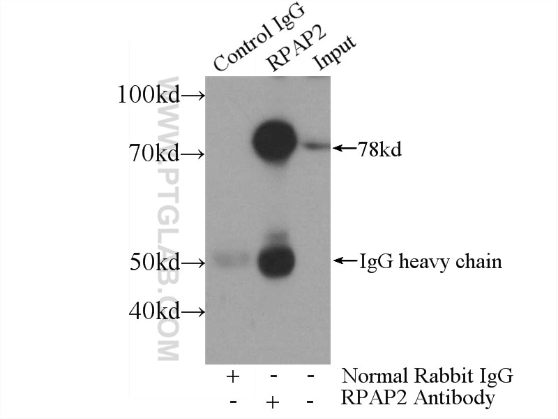 IP experiment of HEK-293 using 17401-1-AP