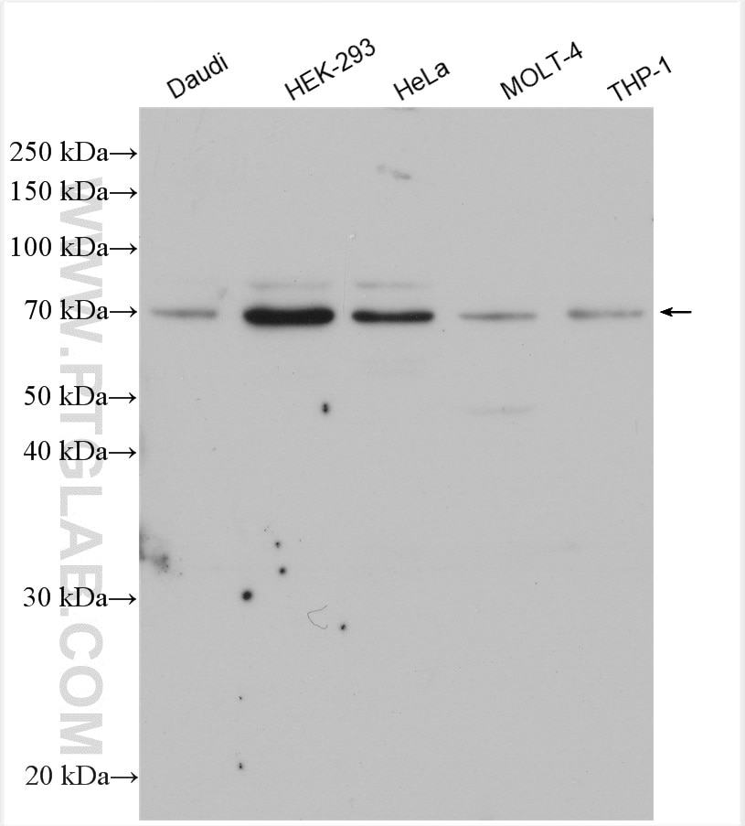 Western Blot (WB) analysis of various lysates using RPAP2 Polyclonal antibody (17401-1-AP)