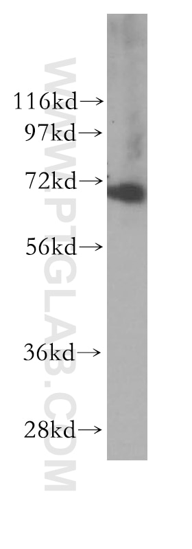 Western Blot (WB) analysis of MCF-7 cells using RPAP2 Polyclonal antibody (17401-1-AP)
