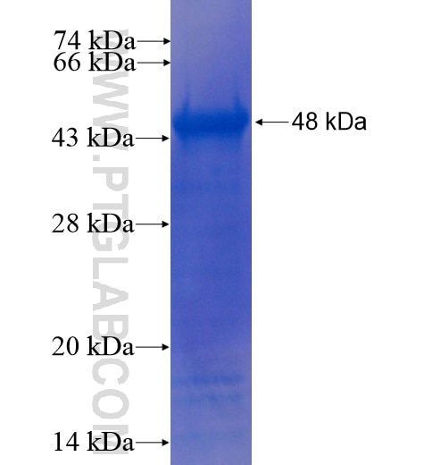 RPAP2 fusion protein Ag11342 SDS-PAGE