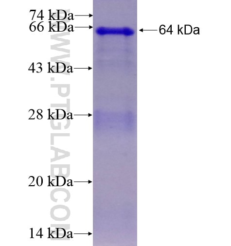 RPAP2 fusion protein Ag11374 SDS-PAGE