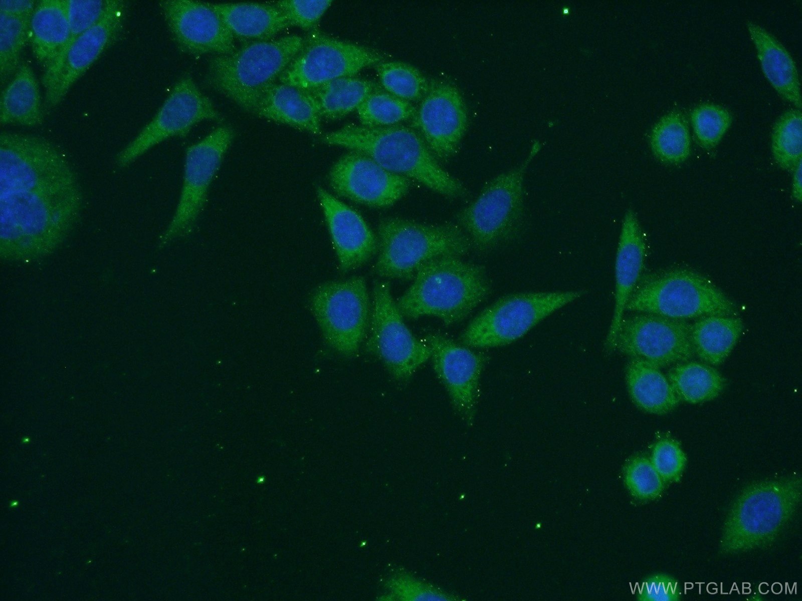 Immunofluorescence (IF) / fluorescent staining of HeLa cells using RPAP3 Polyclonal antibody (23741-1-AP)
