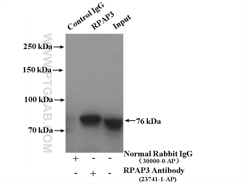 Immunoprecipitation (IP) experiment of HEK-293 cells using RPAP3 Polyclonal antibody (23741-1-AP)