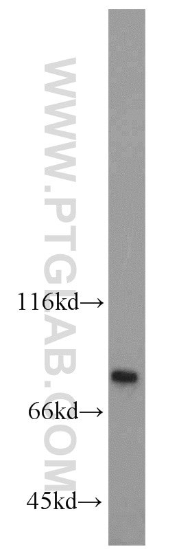 Western Blot (WB) analysis of HEK-293 cells using RPAP3 Polyclonal antibody (23741-1-AP)