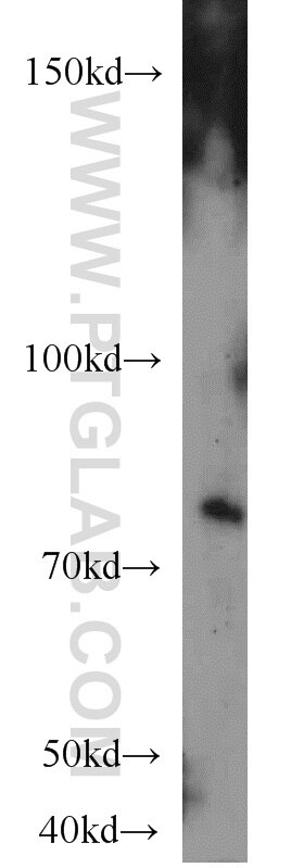 Western Blot (WB) analysis of Jurkat cells using RPAP3 Polyclonal antibody (23741-1-AP)