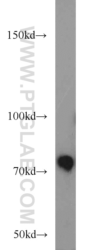 Western Blot (WB) analysis of HeLa cells using RPAP3 Polyclonal antibody (23741-1-AP)