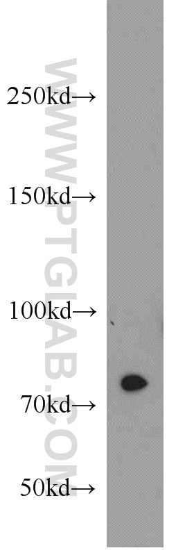 Western Blot (WB) analysis of Jurkat cells using RPAP3 Polyclonal antibody (23741-1-AP)