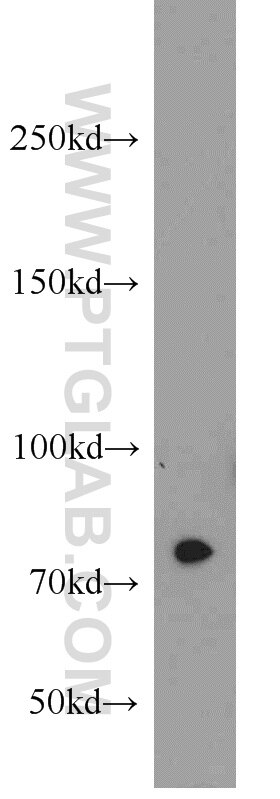 WB analysis of Jurkat using 23741-1-AP