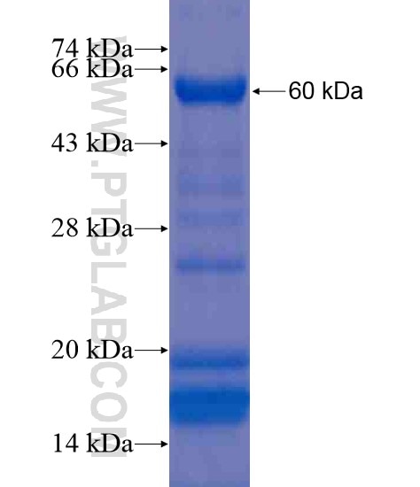 RPAP3 fusion protein Ag20661 SDS-PAGE