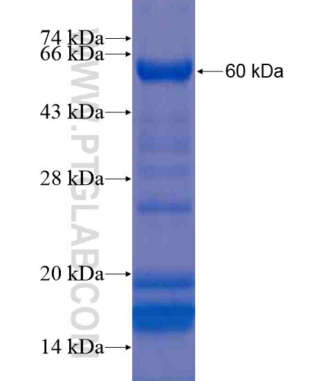 RPAP3 fusion protein Ag20661 SDS-PAGE