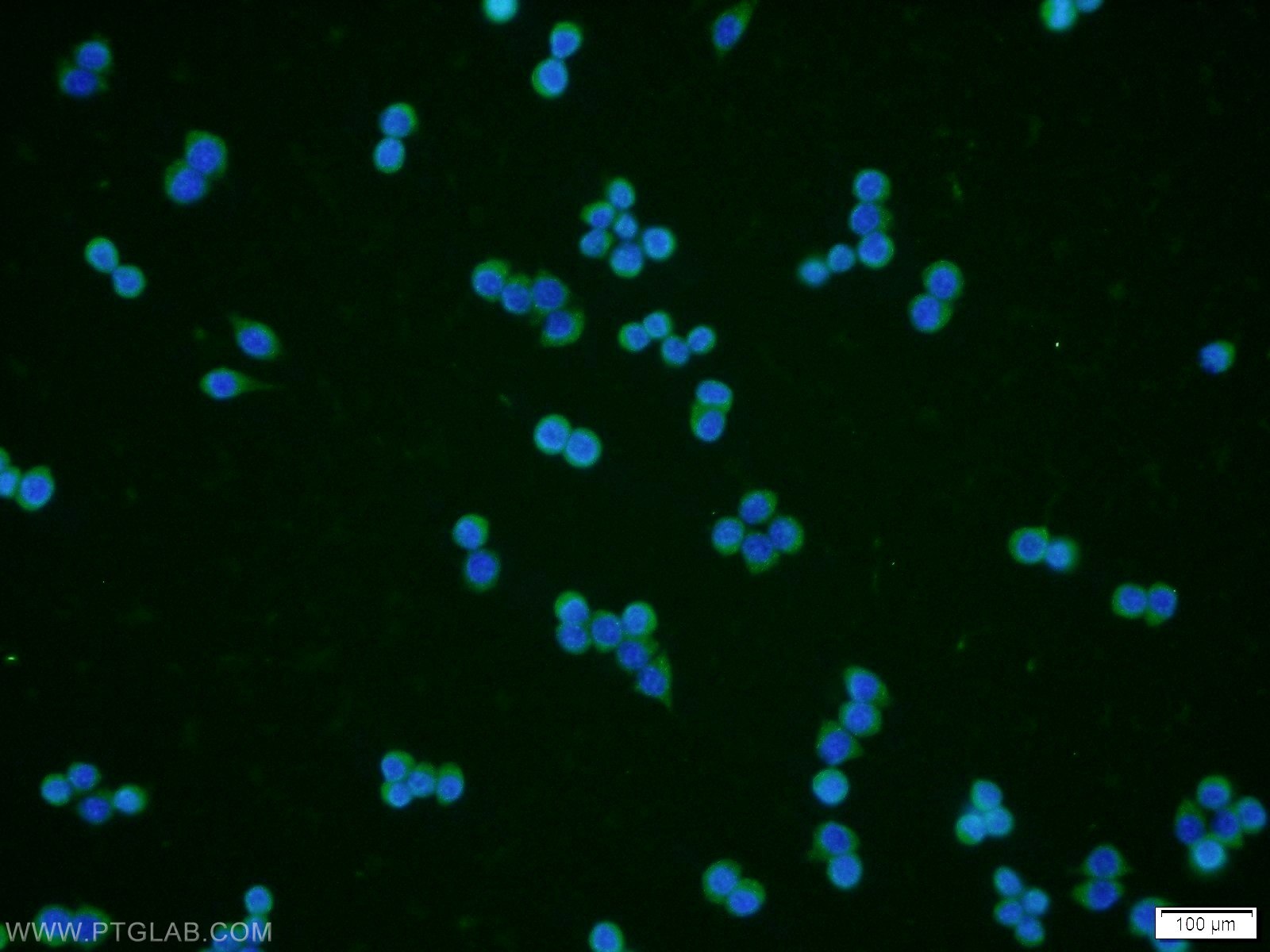 Immunofluorescence (IF) / fluorescent staining of RAW 264.7 cells using RPE Polyclonal antibody (12168-2-AP)