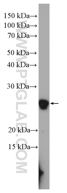 Western Blot (WB) analysis of HeLa cells using RPE Polyclonal antibody (12168-2-AP)