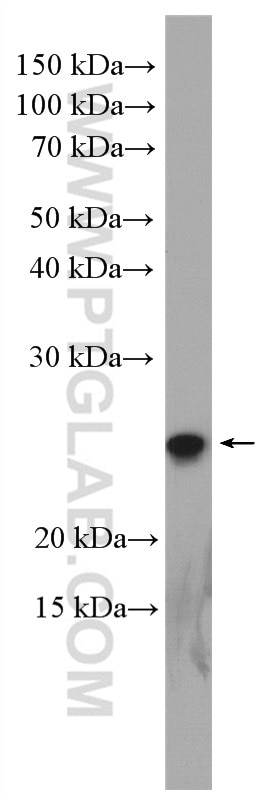 Western Blot (WB) analysis of K-562 cells using RPE Polyclonal antibody (12168-2-AP)