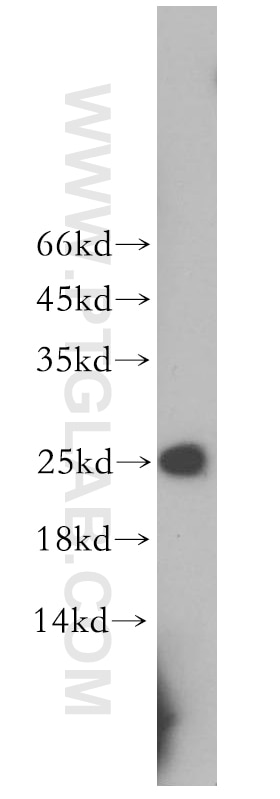 Western Blot (WB) analysis of mouse thymus tissue using RPE Polyclonal antibody (12168-2-AP)