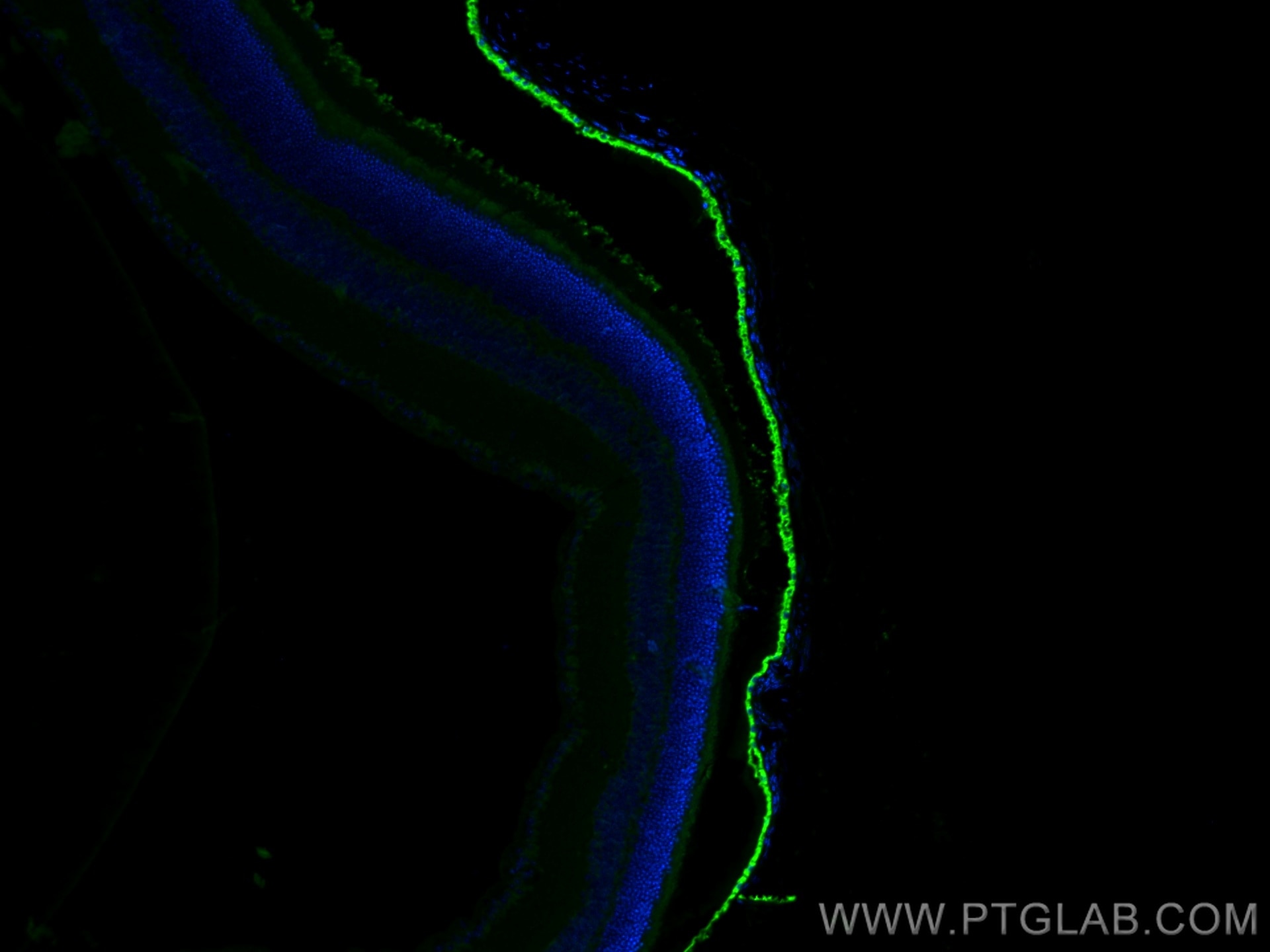 Immunofluorescence (IF) / fluorescent staining of mouse eye tissue using RPE65 Polyclonal antibody (17939-1-AP)