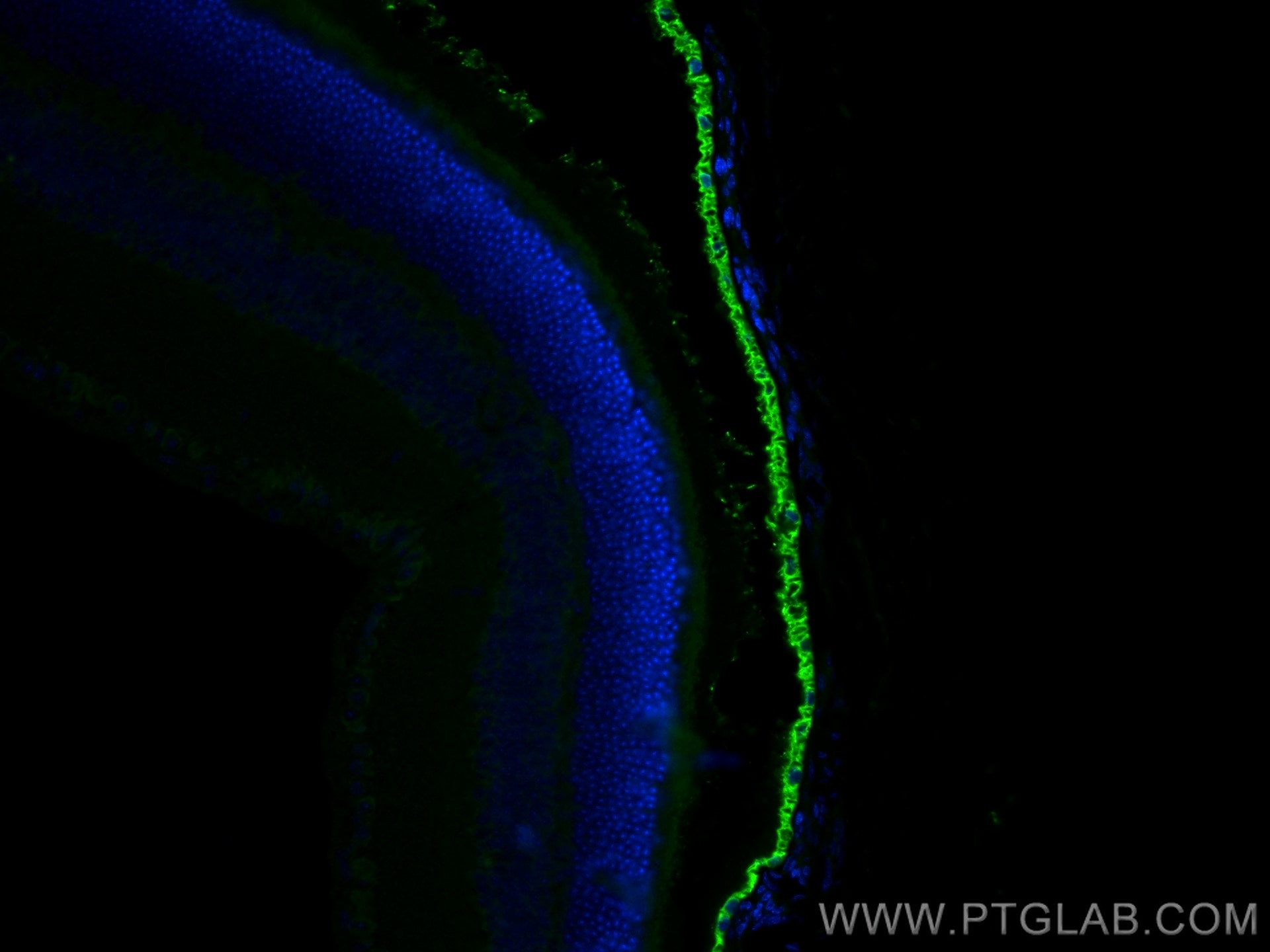 Immunofluorescence (IF) / fluorescent staining of mouse eye tissue using RPE65 Polyclonal antibody (17939-1-AP)