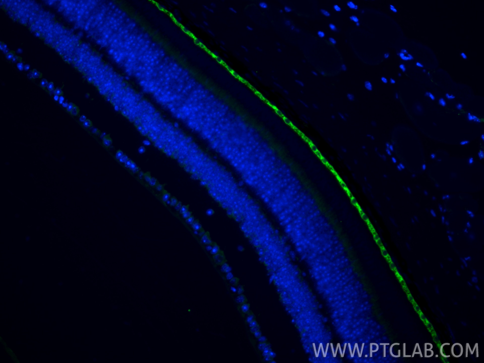 IF Staining of mouse eye using 17939-1-AP Immunofluorescence (IF) / fluorescent staining of mouse eye tissue using RPE65 Polyclonal antibody (17939-1-AP)
