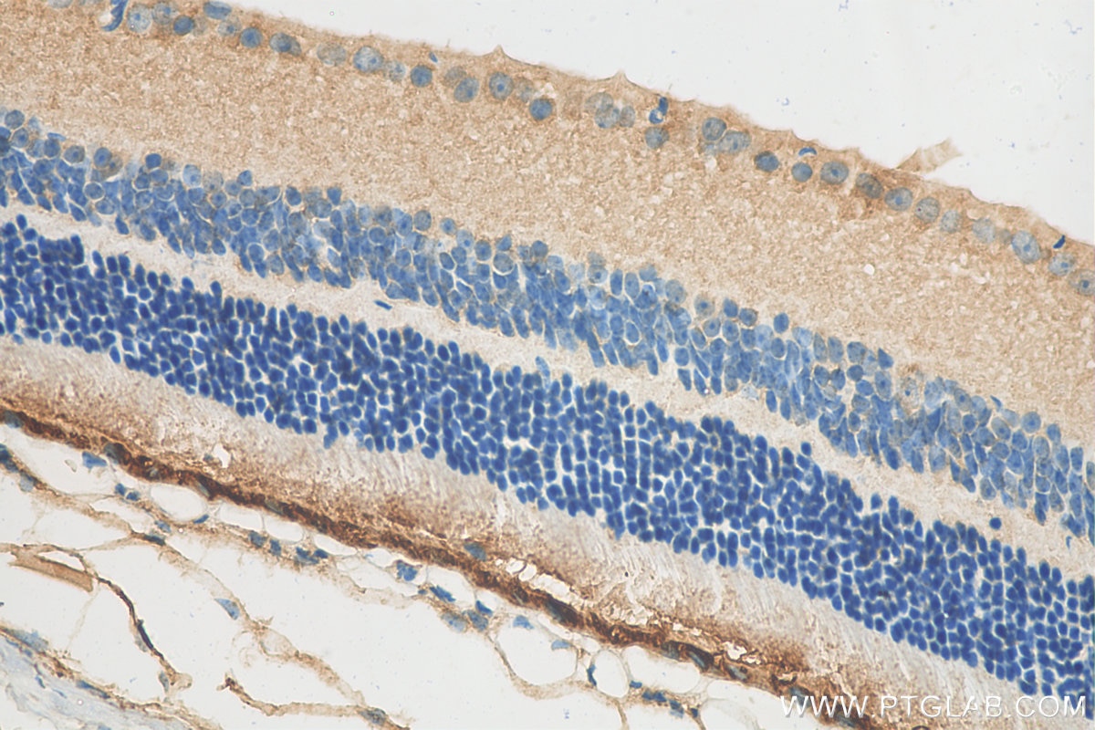 Immunohistochemistry (IHC) staining of mouse eye tissue using RPE65 Polyclonal antibody (17939-1-AP)