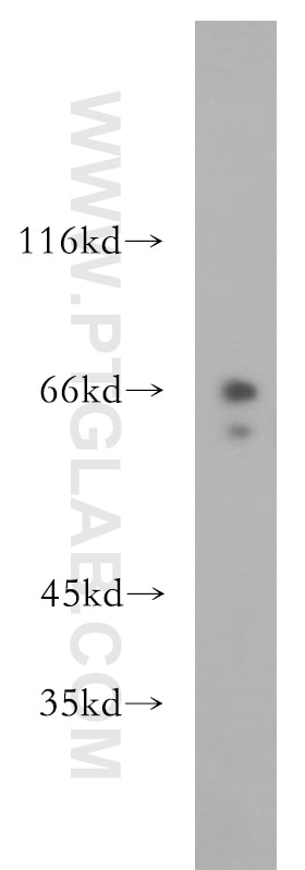 Western Blot (WB) analysis of HeLa cells using RPE65 Polyclonal antibody (17939-1-AP)