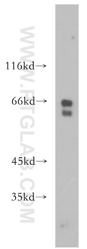 Western Blot (WB) analysis of Y79 cells using RPE65 Polyclonal antibody (17939-1-AP)