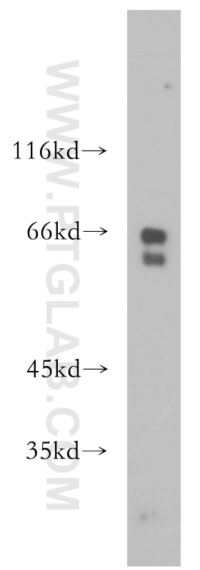 RPE65 Polyclonal antibody