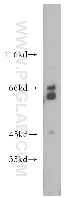 Western Blot (WB) analysis of PC-3 cells using RPE65 Polyclonal antibody (17939-1-AP)
