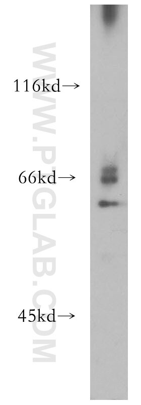 Western Blot (WB) analysis of mouse eye tissue using RPE65 Polyclonal antibody (17939-1-AP)