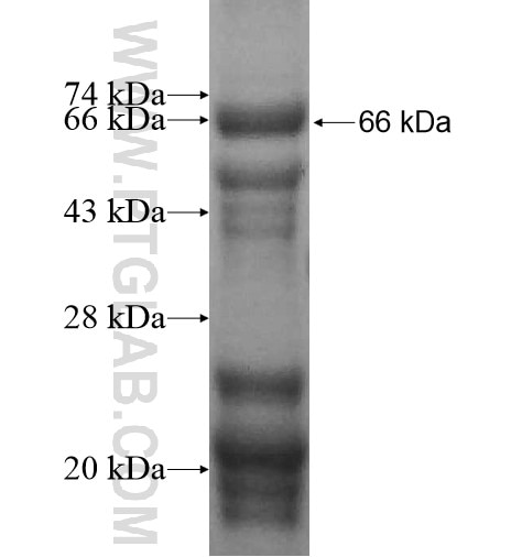 RPE65 fusion protein Ag12356 SDS-PAGE