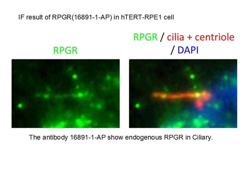 Immunofluorescence (IF) / fluorescent staining of hTERT-RPE1 cells using RPGR Polyclonal antibody (16891-1-AP)